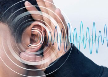 otoemisiunile acustice