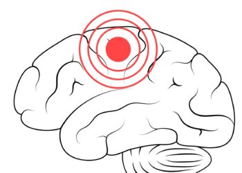 accidentul vascular cerebral