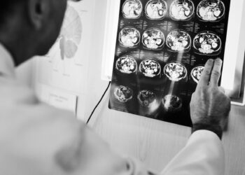 Ce sunt traumatismele craniocerebrale