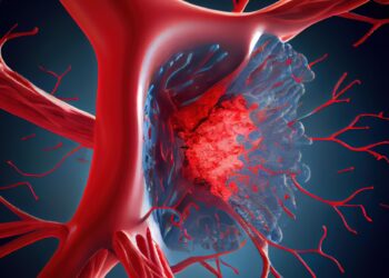 atacul ischemic tranzitoriu