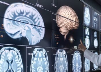 Cum diferențiem epilepsia de alte boli