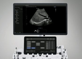 rolul ecografiei în bolile vasculare