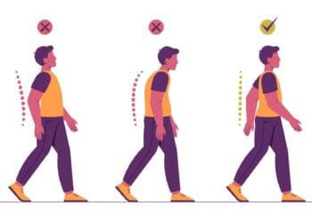 kinetoterapia posturală